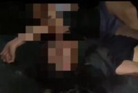 Korban saat dievakuasi ke Rumah sakit