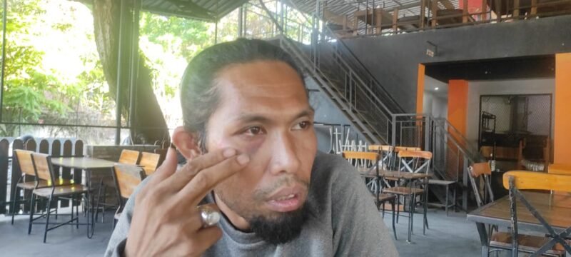 Korban saat ditemui di salah satu warkop usai periksakan kesehatannya di RS.