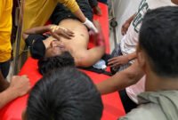 Salah satu korban kecelakaan saat dirawat di RSUD Bone